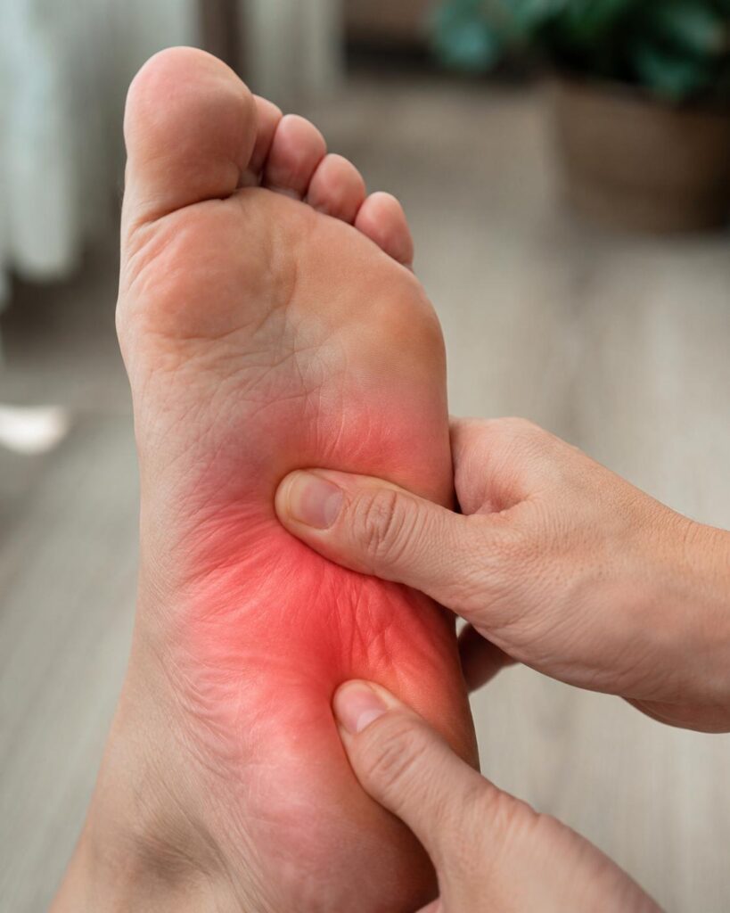 What Is Plantar Fasciitis?